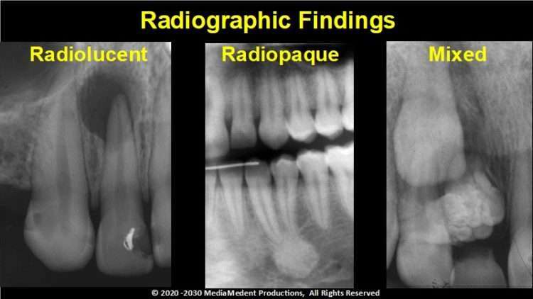 Acclaimed, lectures on radiolucent & radiopaque lesions of the jaws2024